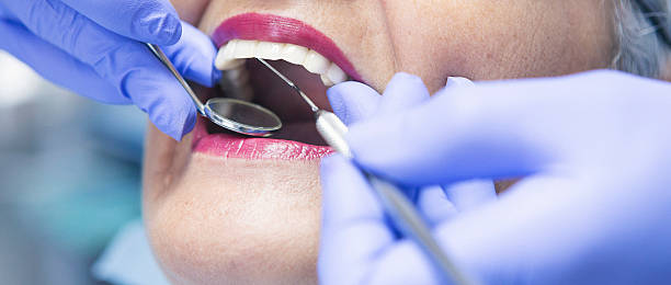 Best Emergency Tooth Extraction in Ronceverte, WV